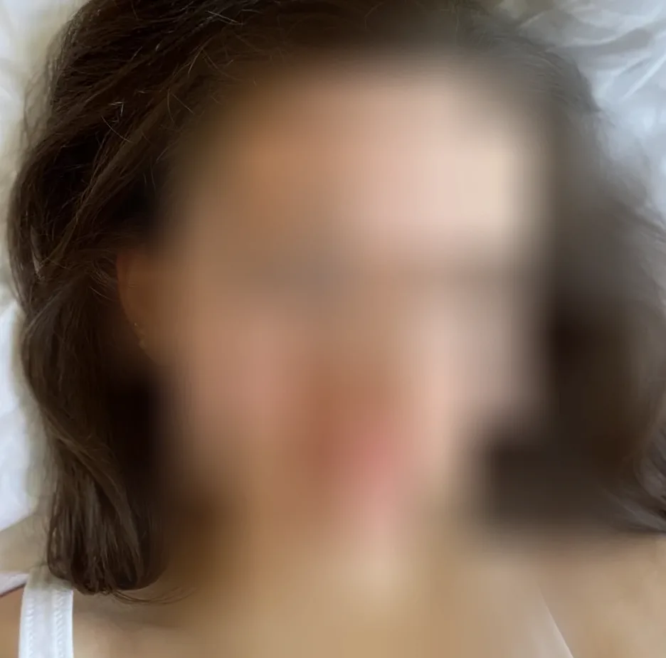 Milla, 24